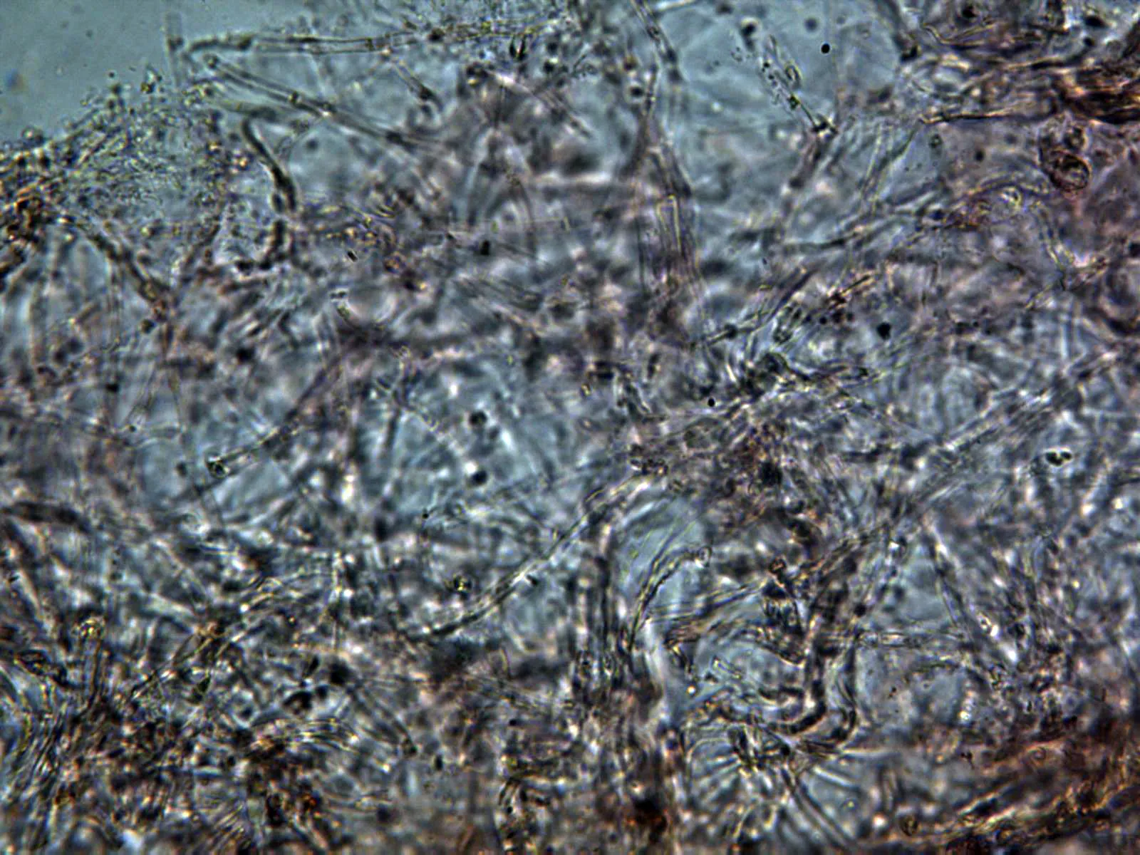 Microscopía de Lactarius zonarius - 14 - Pileipellis x 400